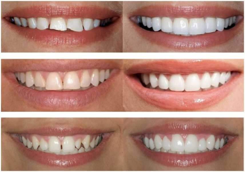 Conocé las novedades odontológicas explicadas por profesionales de la salud bucal imagen-6