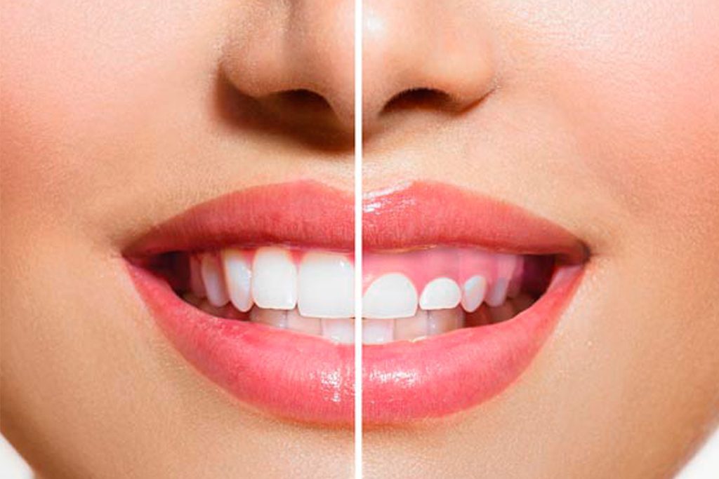 Conocé las novedades odontológicas explicadas por profesionales de la salud bucal imagen-2